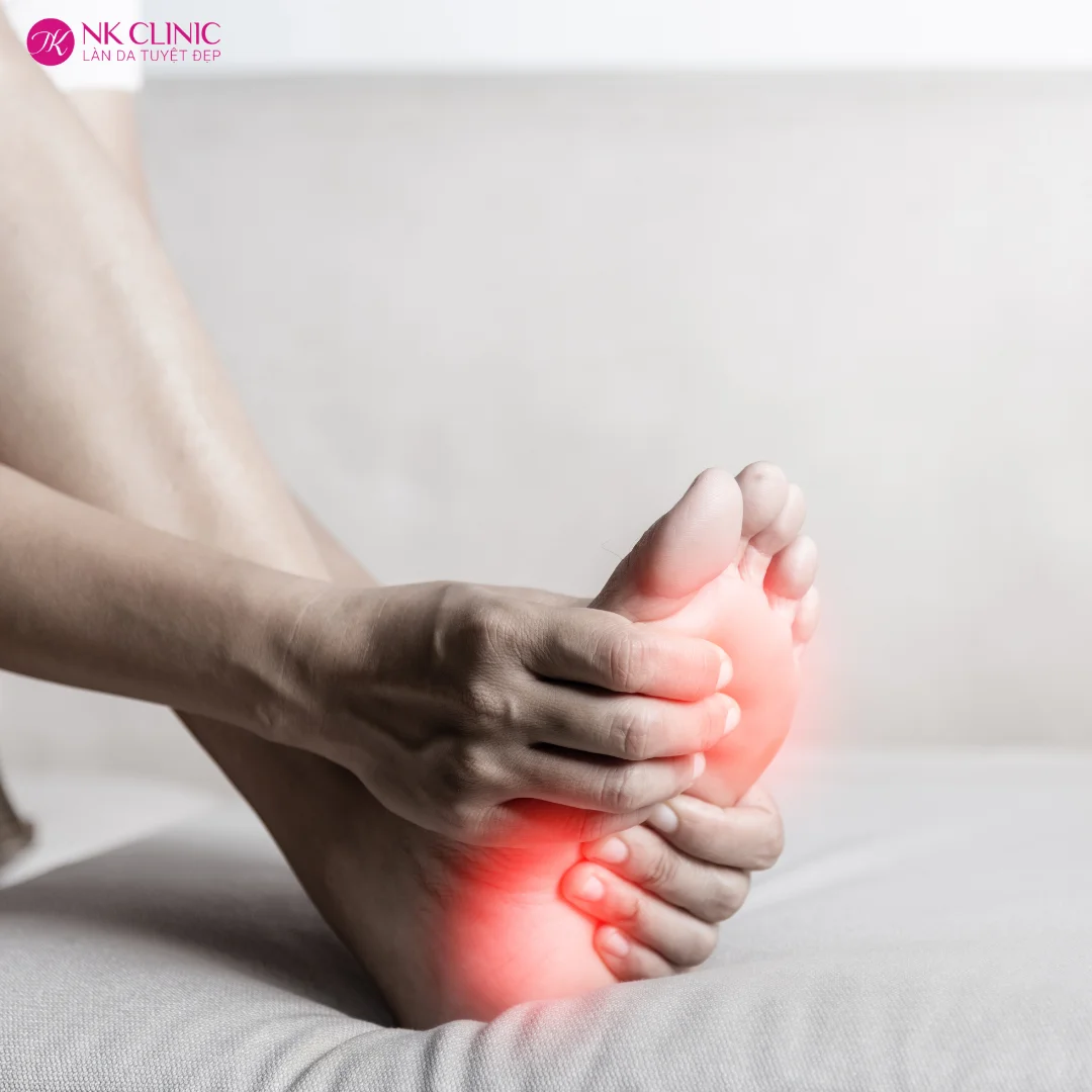 Tê bì và ngứa ran ở chân Tê bì và ngứa ran ở chân