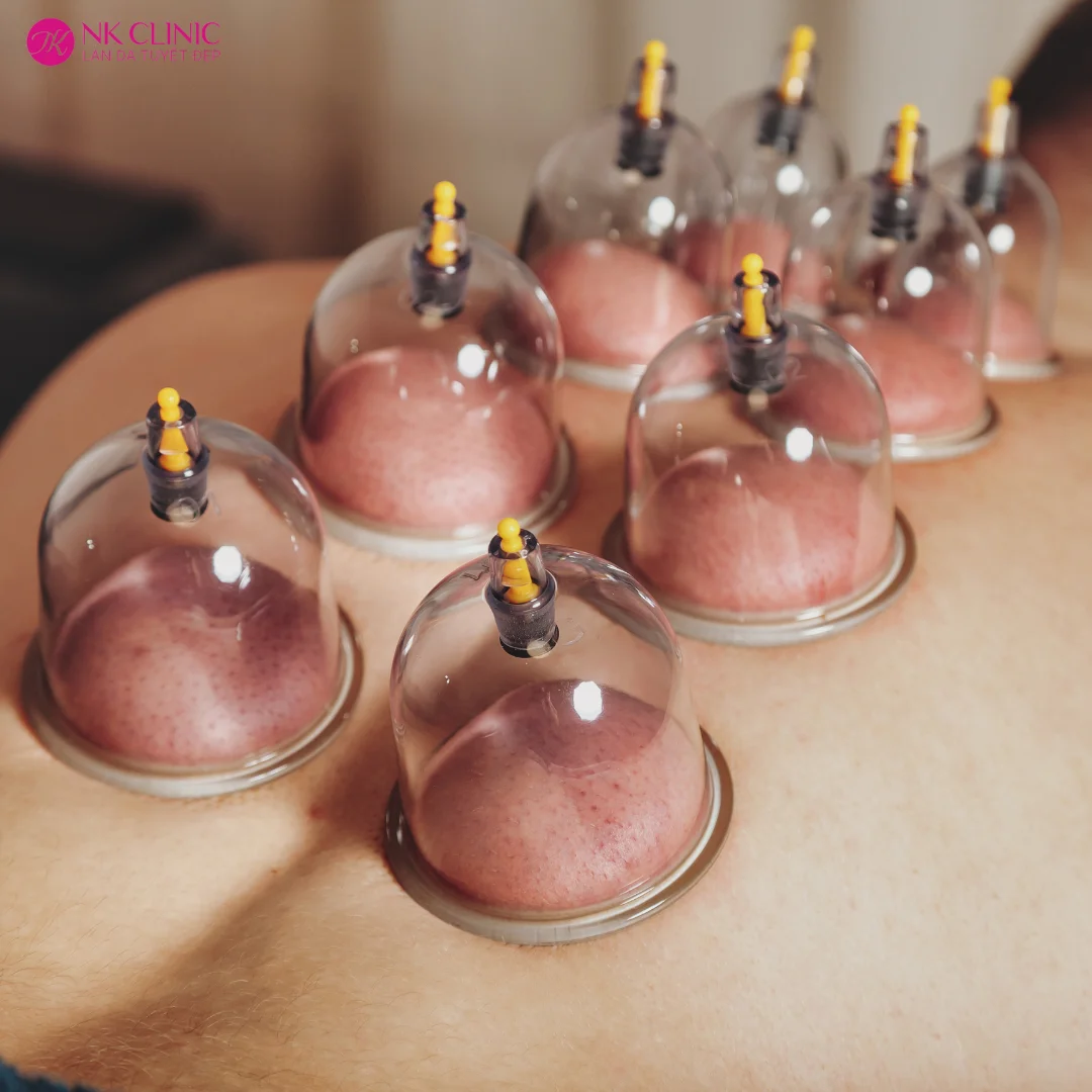 Y học cổ truyền điều chỉnh cơ thể từ bên trong Y học cổ truyền điều chỉnh cơ thể từ bên trong