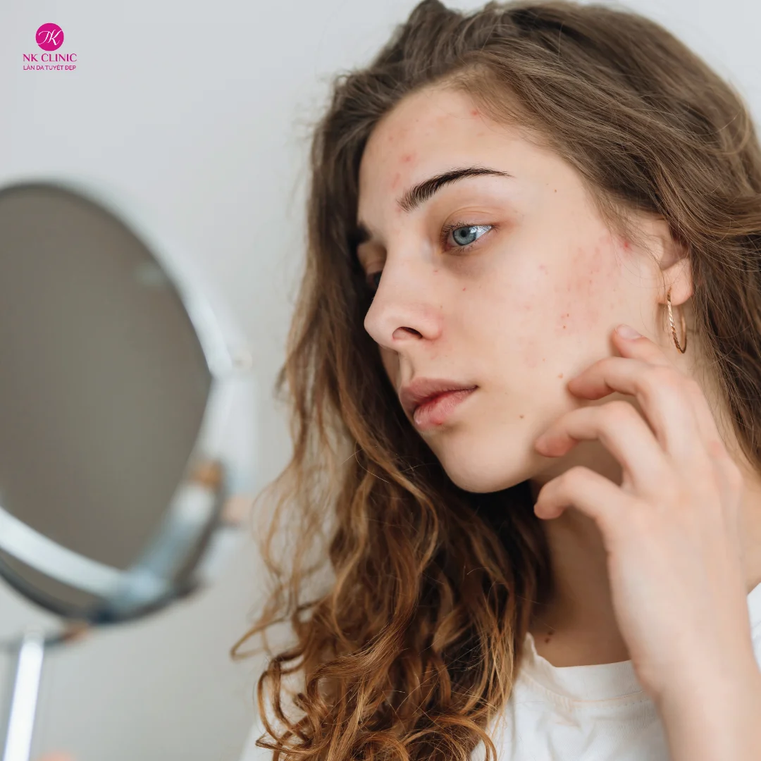 Nguyên nhân làm da mặt chảy xệ là do đâu? Nguyên nhân làm da mặt chảy xệ là do đâu?