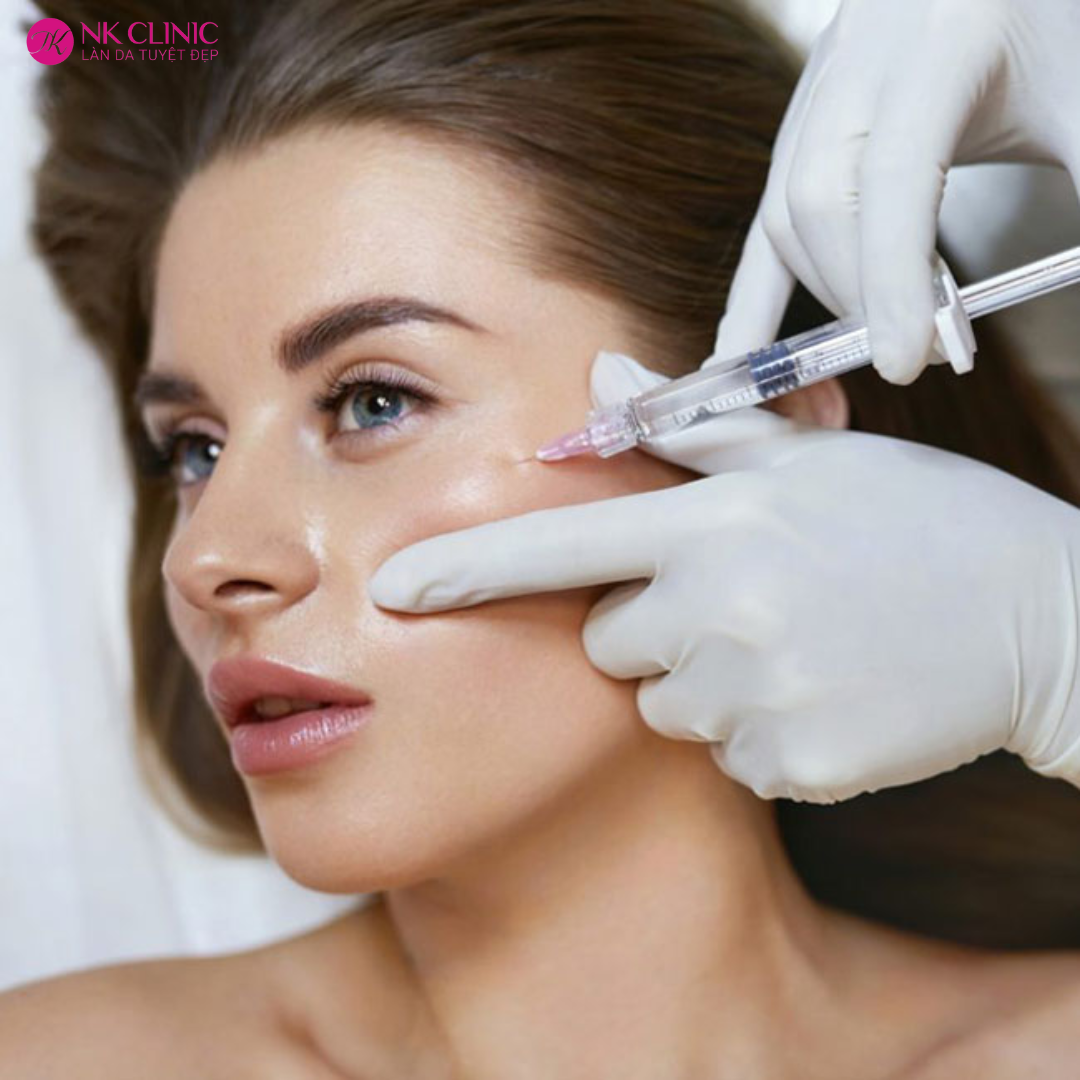 Tiêm căng da mặt duy trì được bao lâu Tiêm căng da mặt duy trì được bao lâu